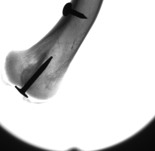 Röntgenbild eines Hühnerknochens